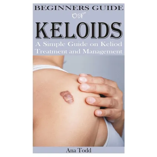 Beginners Guide on Keloids