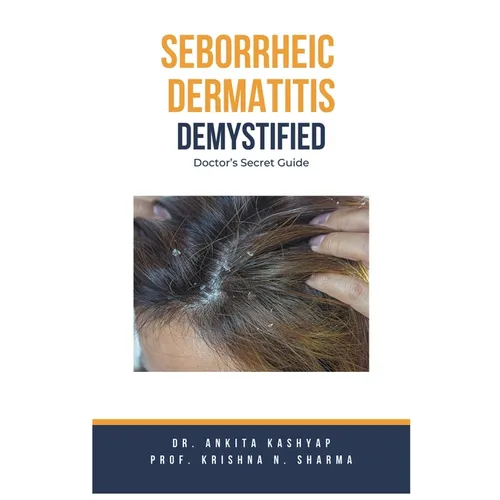 Seborrheic Dermatitis Demystified: Doctor's Secret Guide