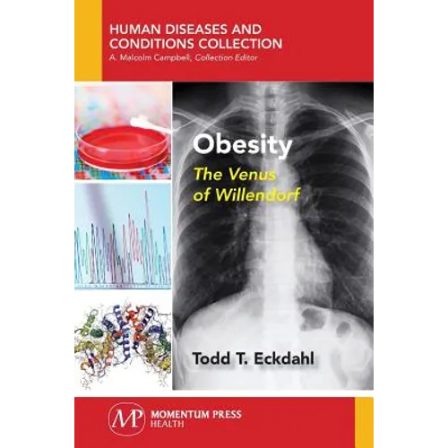 Obesity: The Venus of Willendorf