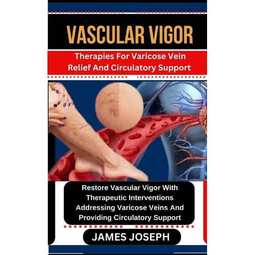Vascular Vigor: Therapies For Varicose Vein Relief And Circulatory Support Restore Vascular Vigor With Therapeutic Interventions Addre