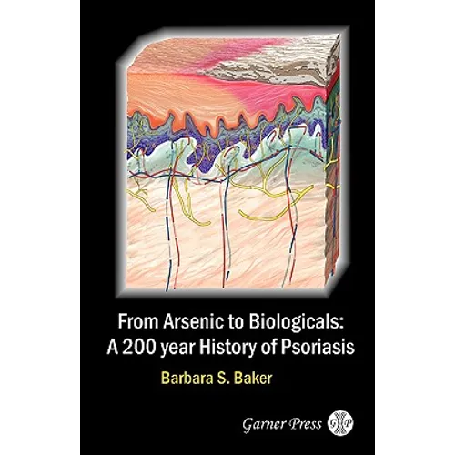 From Arsenic to Biologicals: A 200 Year History of Psoriasis