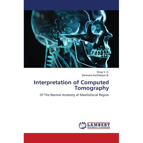 Interpretation of Computed Tomography
