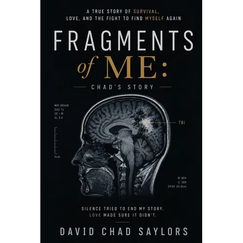 Fragments of Me Chad's Story