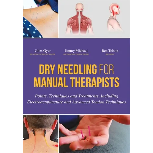 Dry Needling for Manual Therapists: Points, Techniques and Treatments, Including Electroacupuncture and Advanced Tendon Techniques
