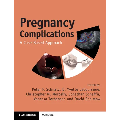 Pregnancy Complications: A Case-Based Approach