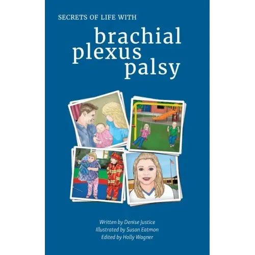 Secrets of Life with Brachial Plexus Palsy