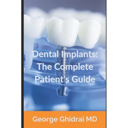 Dental Implants: The Complete Patient's Guide