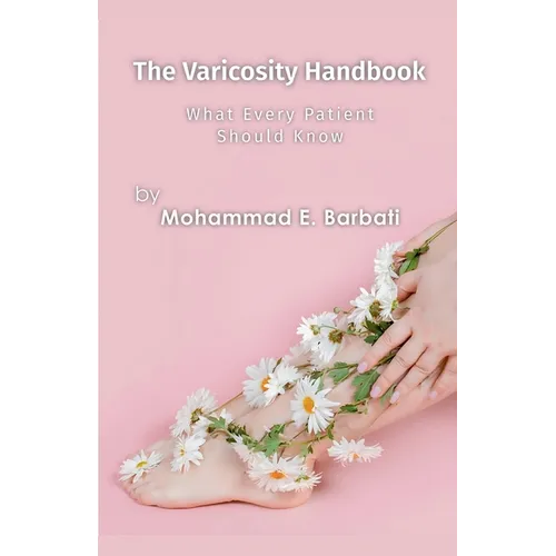 The Varicosity Handbook - What Every Patient Should Know