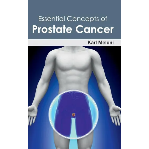 Essential Concepts of Prostate Cancer