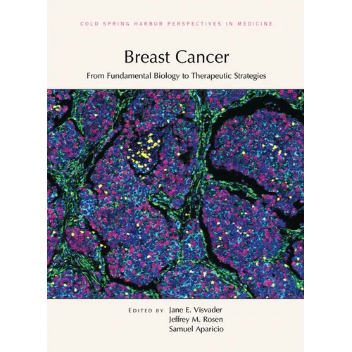 Breast Cancer: From Fundamental Biology to Therapeutic Strategies