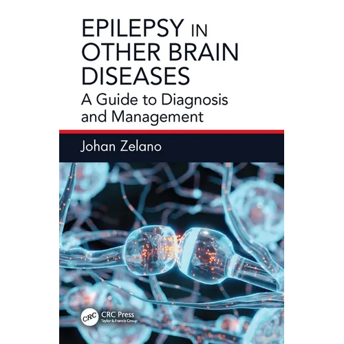 Epilepsy in Other Brain Diseases: A Guide to Diagnosis and Management