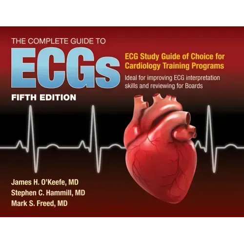 The Complete Guide to Ecgs: A Comprehensive Study Guide to Improve ECG Interpretation Skills: A Comprehensive Study Guide to Improve ECG Interpretatio