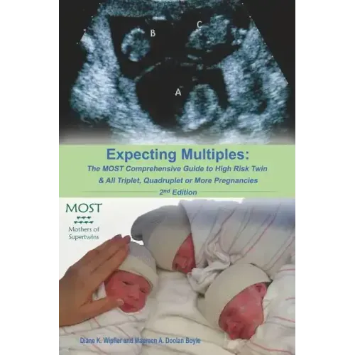 Expecting Multiples: The MOST Comprehensive Guide to High-risk Twin & All Triplet, Quadruplet or More Pregnancies 2nd Edition