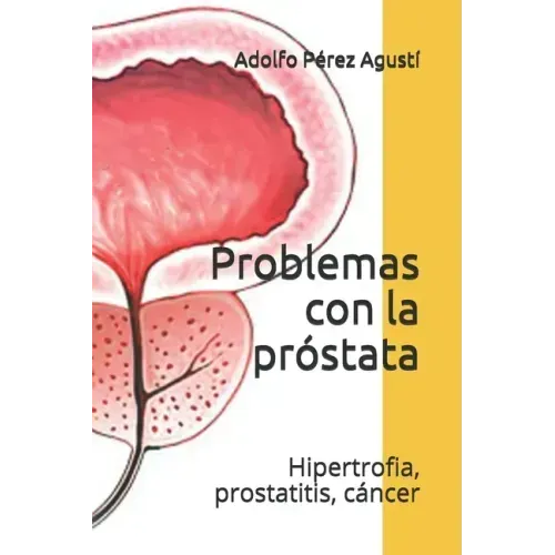 Problemas con la próstata: Hipertrofia, prostatitis, cáncer