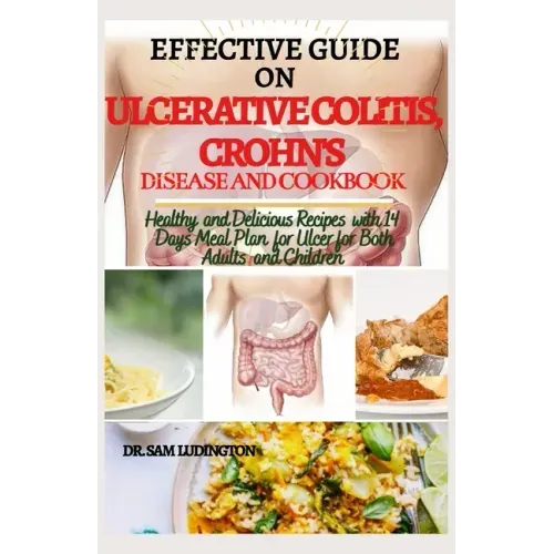 Effective Guide on Ulcerative Colitis, Crohn's Disease and Cookbook: Healthy and Recipes with 14 days meal plan for ulcer for both adults and children