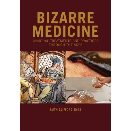 Bizarre Medicine: Unusual Treatments and Practices through the Ages
