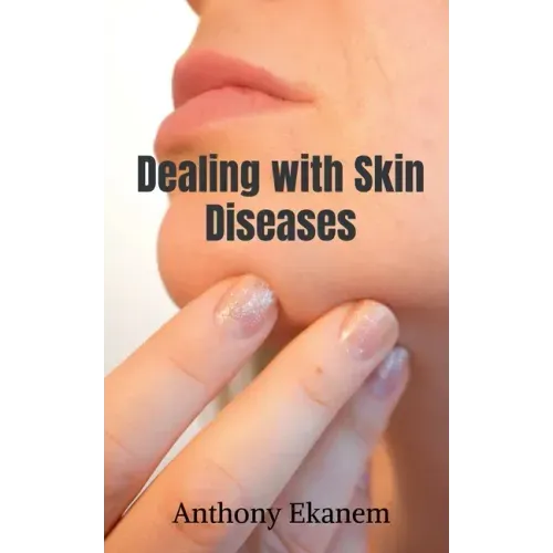Dealing with Skin Diseases