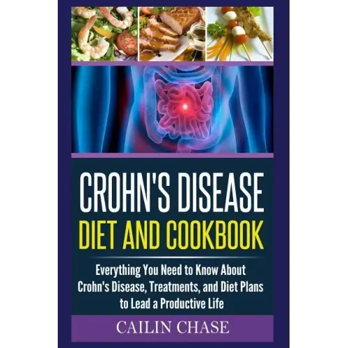 Crohns Disease: The Ultimate Guide For The Treatment and Relief From Crohn's Disease ( Crohns Disease Crohns Cookbook)