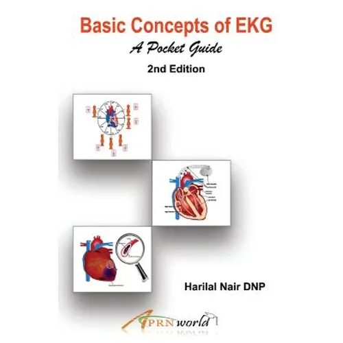 Basic Concepts of EKG: A Pocket Guide