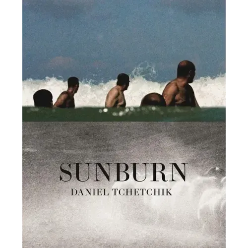 Sunburn