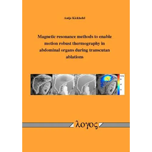Magnetic Resonance Methods to Enable Motion Robust Thermography in Abdominal Organs During Transcutan Ablations