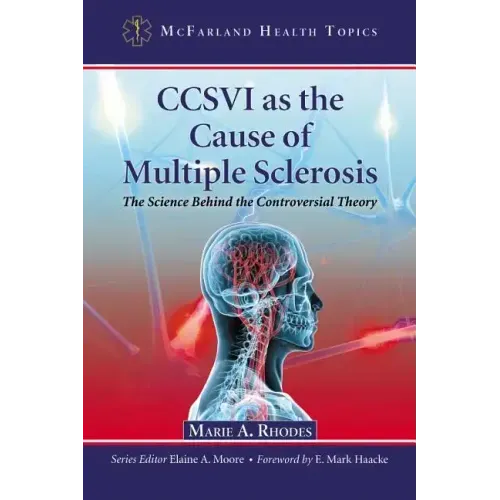 CCSVI as the Cause of Multiple Sclerosis: The Science Behind the Controversial Theory