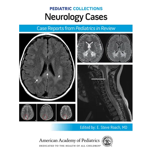 Pediatric Collections: Neurology Cases: Case Reports from Pediatrics in Review