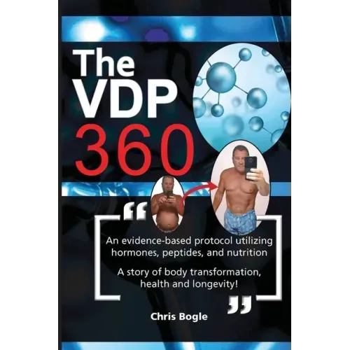 The VDP360