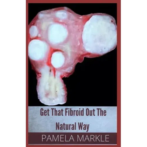 Get That Fibroid Out the Natural Way
