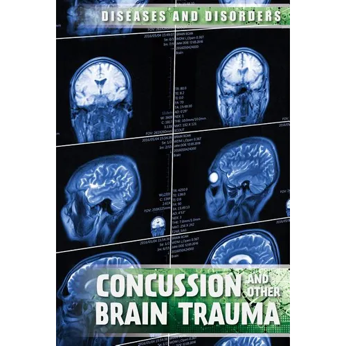Concussions and Other Brain Trauma