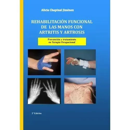 Rehabilitación funcional de las manos con artritis y artrosis: Prevención y tratamiento