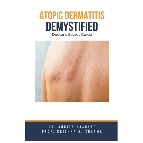 Atopic Dermatitis Demystified: Doctor's Secret Guide