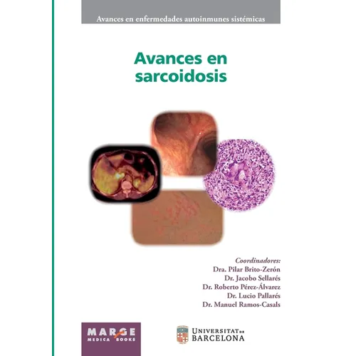 Avances en sarcoidosis