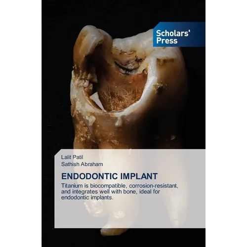 Endodontic Implant