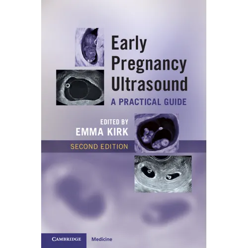 Early Pregnancy Ultrasound: A Practical Guide