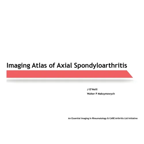Imaging Atlas of Axial Spondyloarthritis