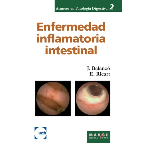 Enfermedad inflamatoria intestinal