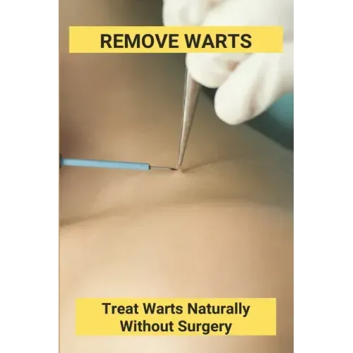 Remove Warts: Treat Warts Naturally Without Surgery: Boost Immune System To Get Rid Of Warts