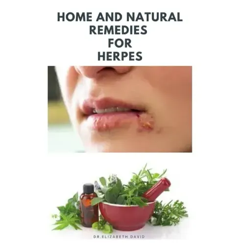 Home and Natural Remedies for Herpes: The Best Herbal And Natural Remedies To Get Rid Of All Form Of Herpes Virus