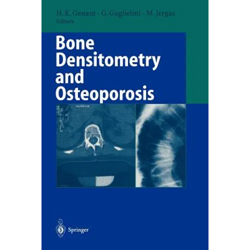 Bone Densitometry and Osteoporosis