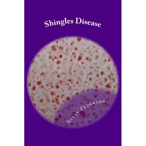 Shingles Disease: The Complete Guide