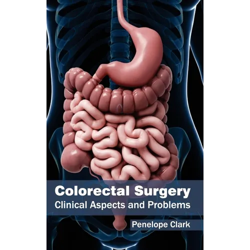 Colorectal Surgery: Clinical Aspects and Problems