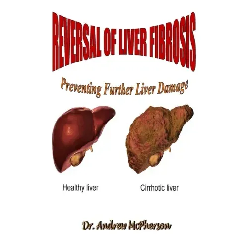 Reversal of Liver Fibrosis: Preventing Further Liver Damage