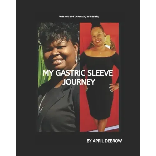 My Gastric Sleeve Journey: The ends and Outs About Gastric Sleeve