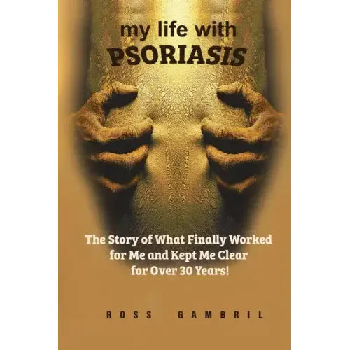 my life with PSORIASIS: The story of what finally worked for me and kept me clear for over 30 years!