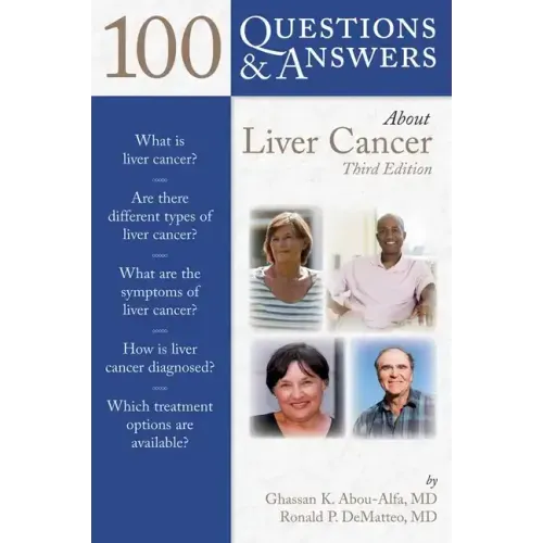 100 Q&as about Liver Cancer 3e