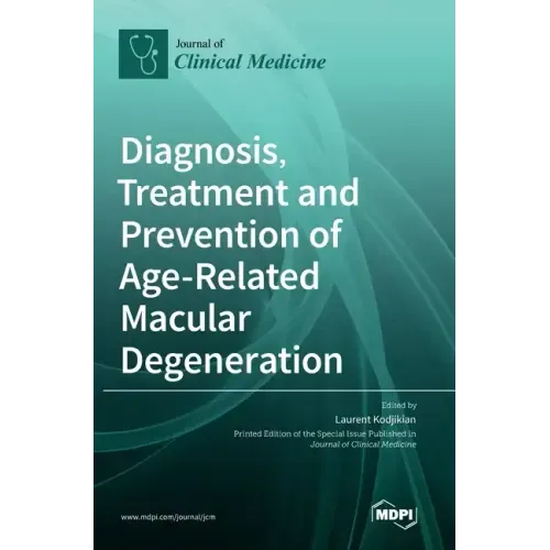 Diagnosis, Treatment and Prevention of Age-Related Macular Degeneration