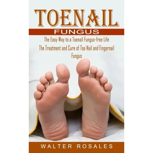 Toenail Fungus: The Easy Way to a Toenail Fungus-free Life (The Treatment and Cure of Toe Nail and Fingernail Fungus)
