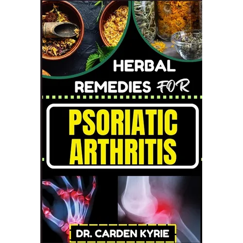 Herbal Remedies for Psoriatic Arthritis: Empower Your Journey To Wellness With Herbs For Alleviating Pain, Restoring Joint Health And Nurturing Overal
