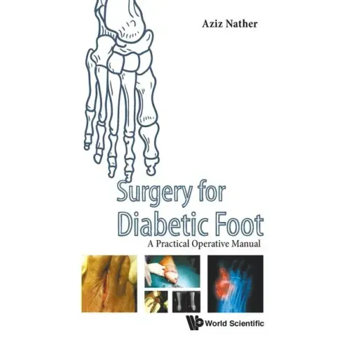 Surgery for Diabetic Foot: A Practical Operative Manual